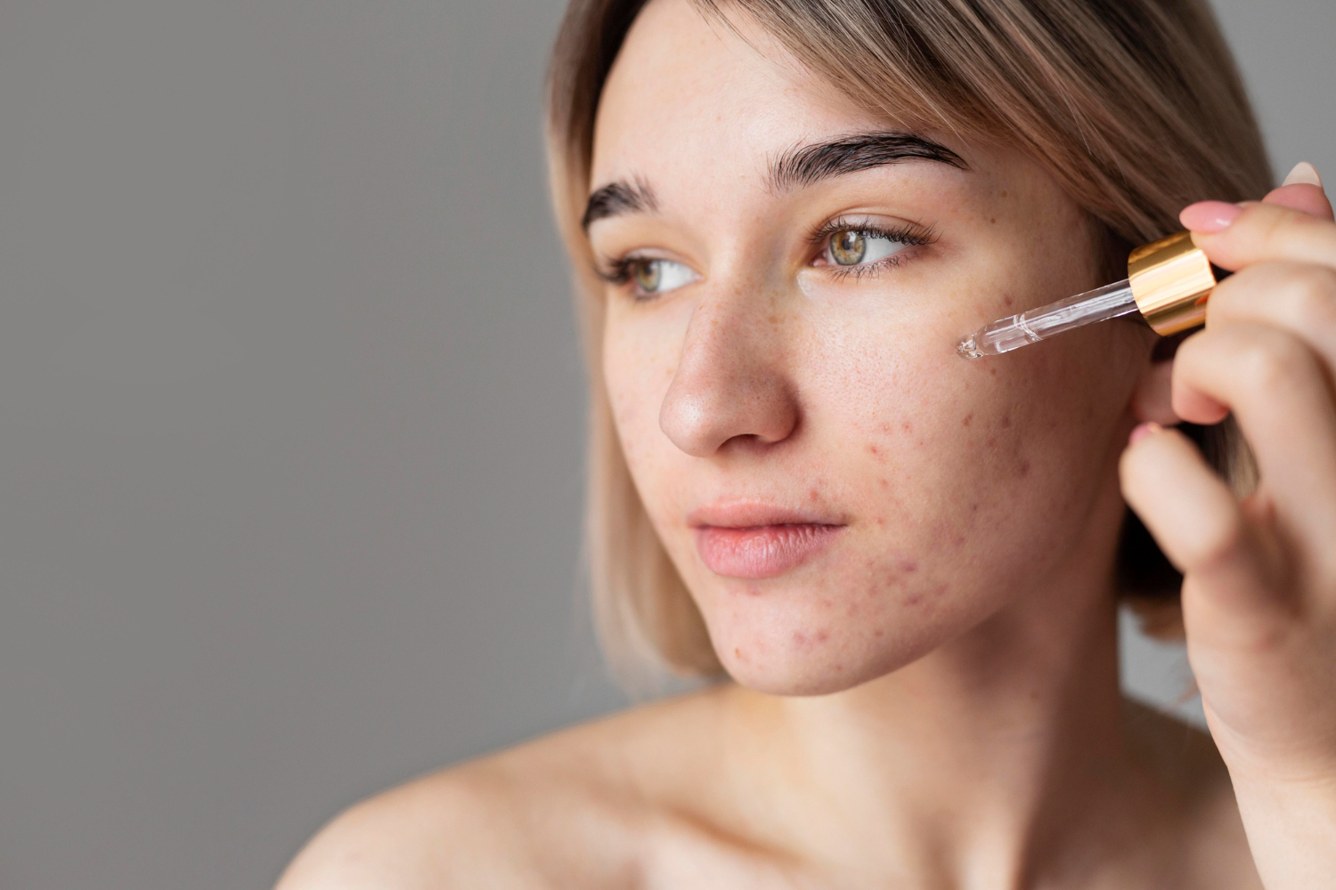 5 Serum untuk Atasi Bekas Jerawat Kemerahan, Ada Whitelab