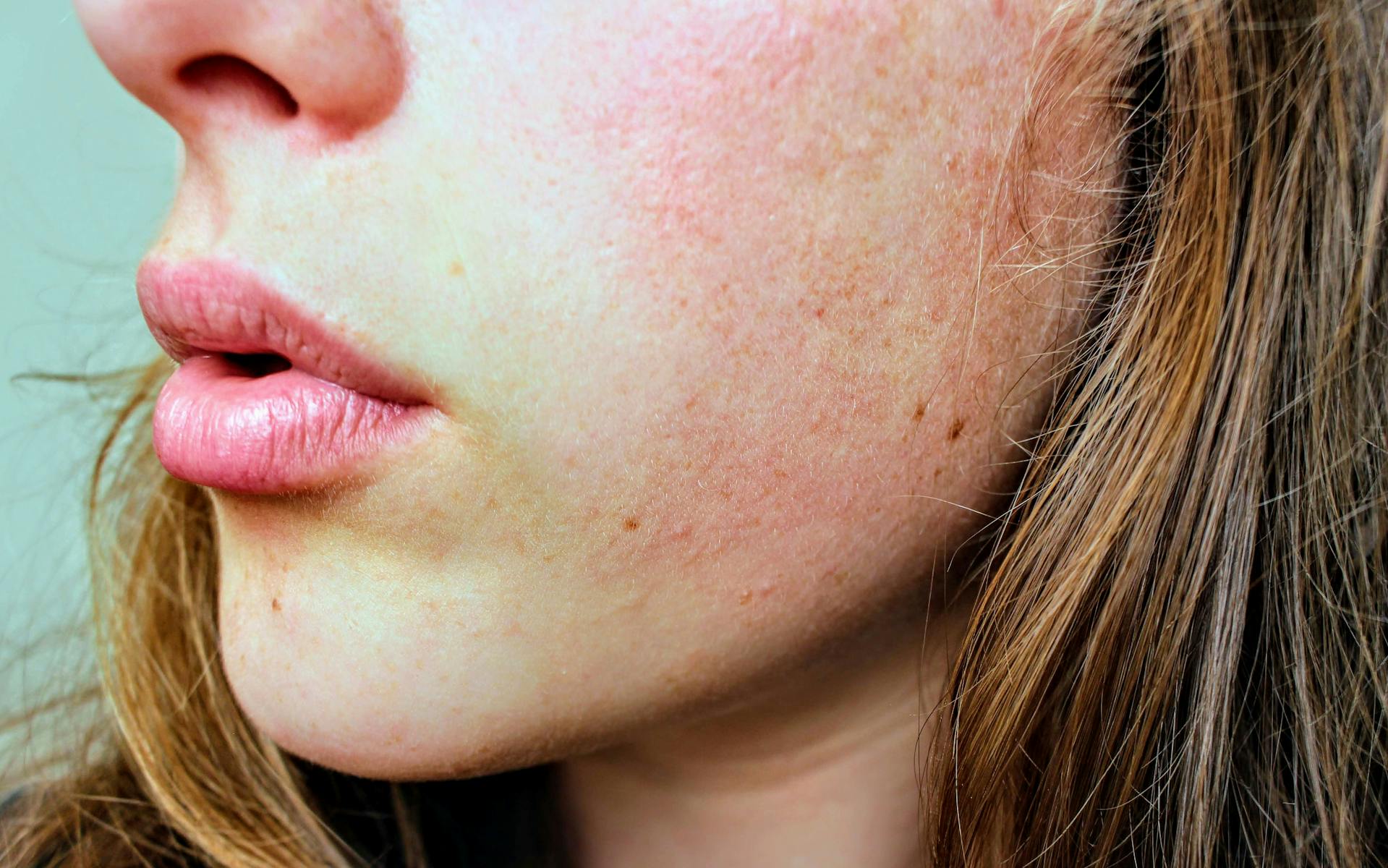 6 Tips Atasi Kulit Kering di Musim Hujan, Pakai Humidifier?