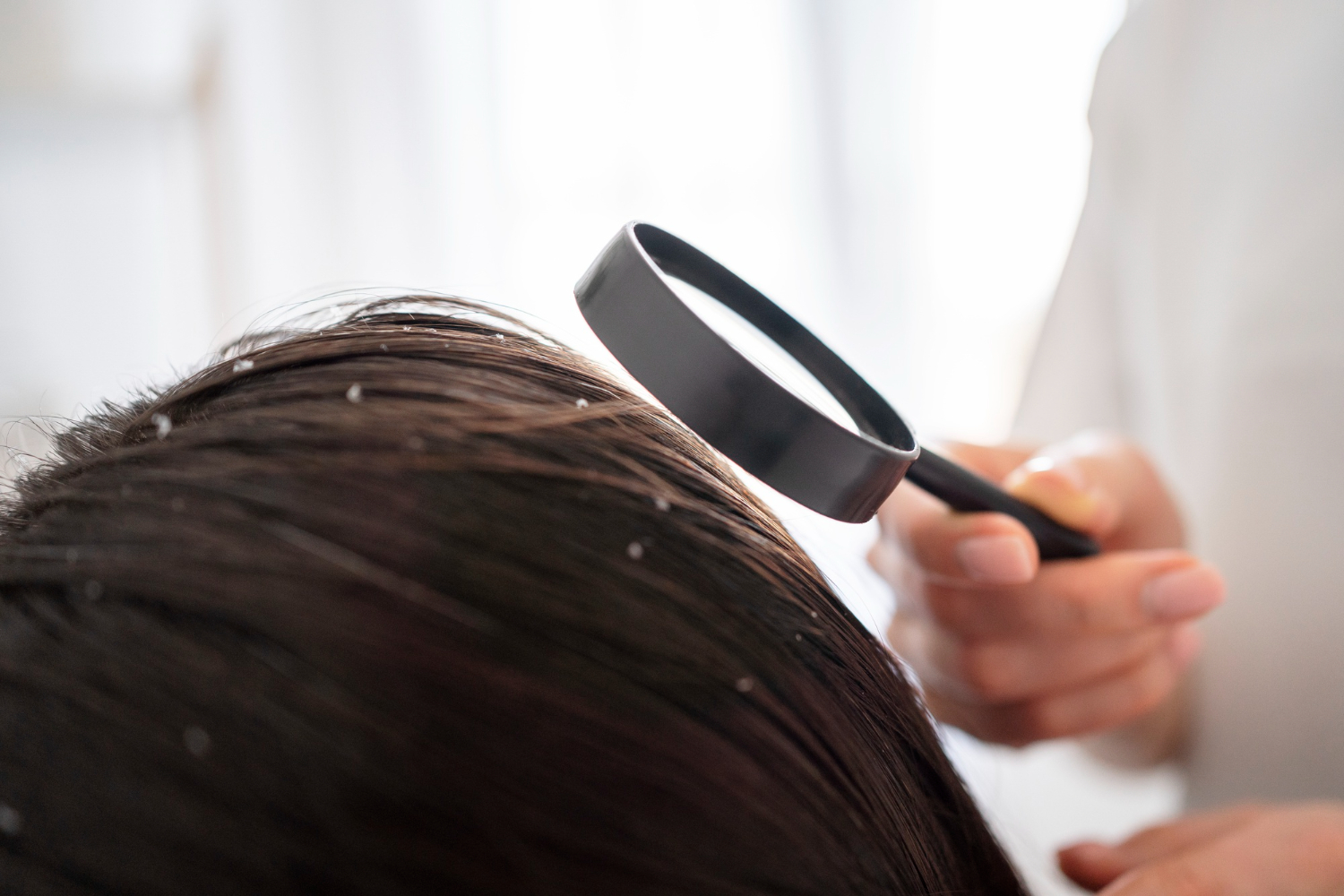 5 Penyebab Munculnya Kutu Rambut dan Cara Alami untuk Mengatasinya