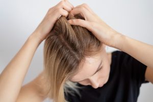6 Cara Alami untuk Atasi Rambut Ketombe, Pakai Minyak Jarak?